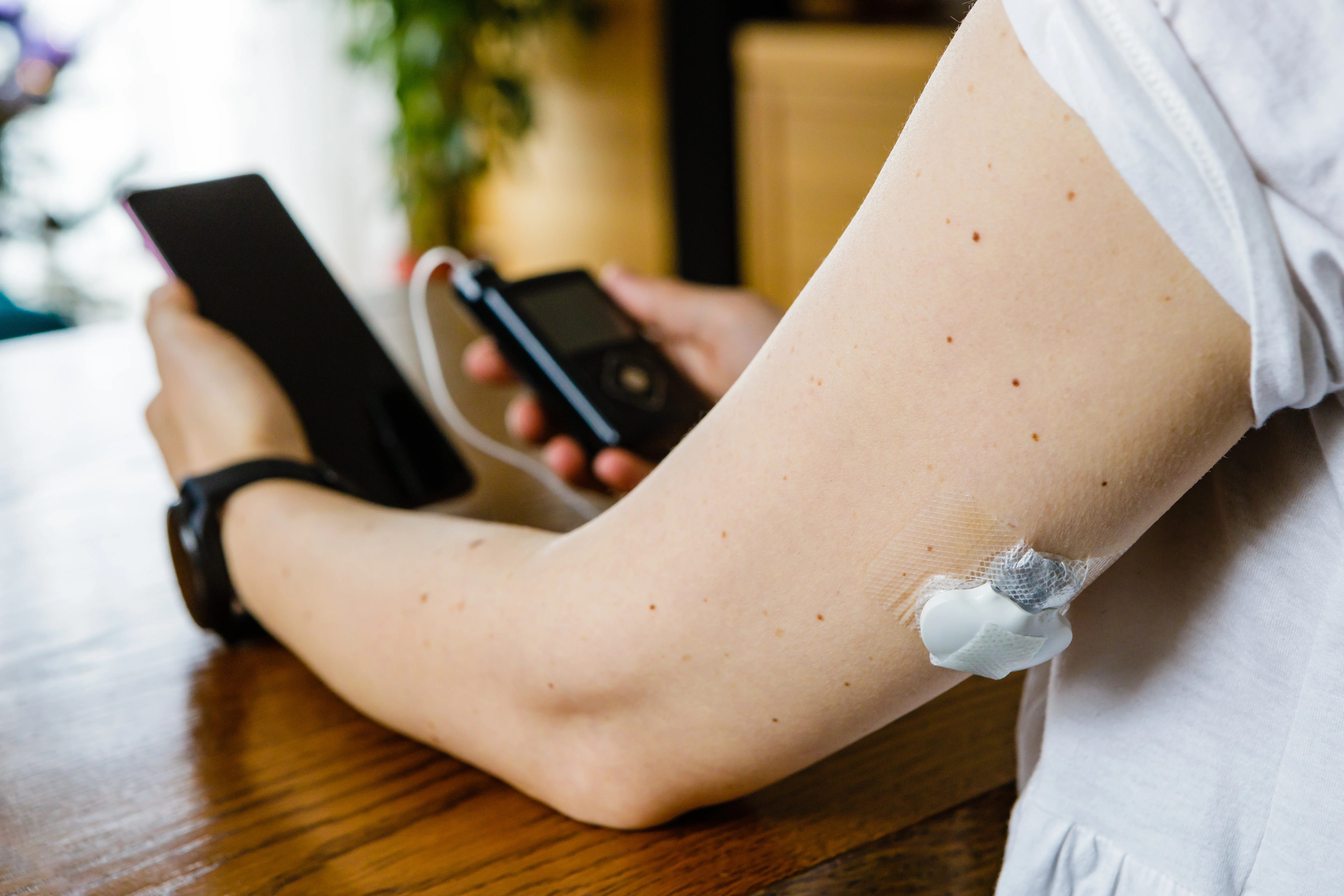 A person with a glucose sensor on the upper arm holding an insulin pump and a smartphone